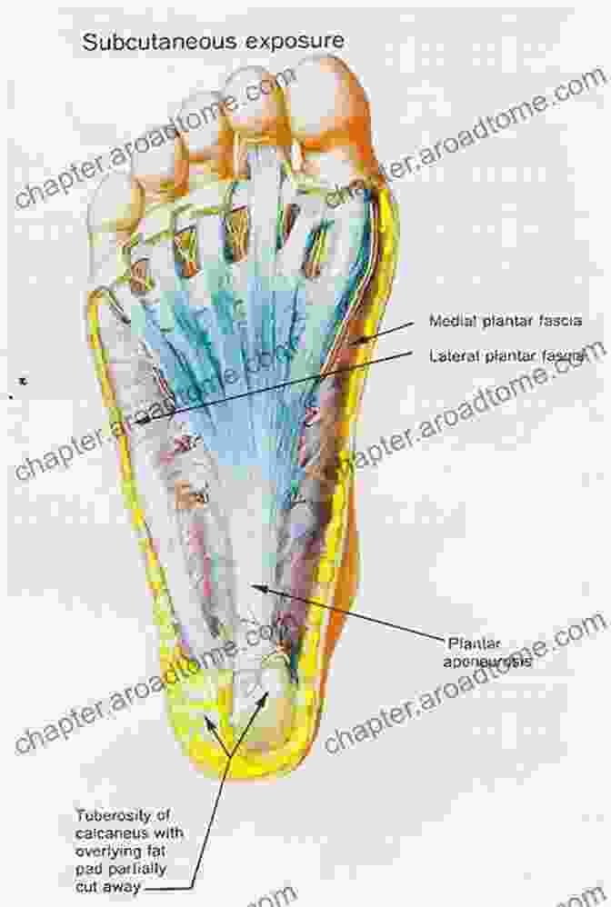 Anatomy Of The Plantar Fascia Plantar Fasciitis Survival Guide: The Ultimate Program To Beat Plantar Fasciitis