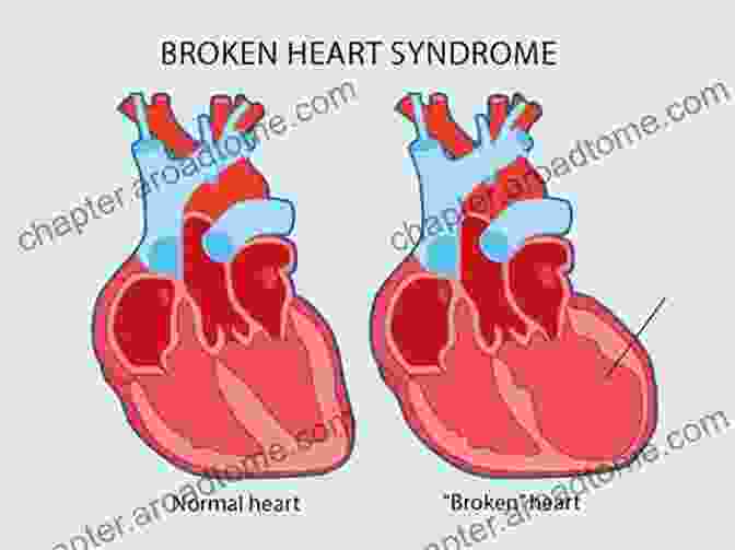 Diagram Of The Anatomy Of A Broken Heart EVOLVE: From Heart Breaks To Hearts Healed