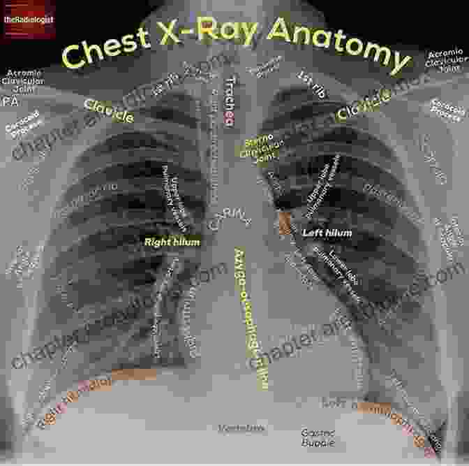 Fundamentals Of Chest Radiology Anatomy, Physiology, And Radiographic Techniques What Radiology Residents Need To Know: Chest Radiology