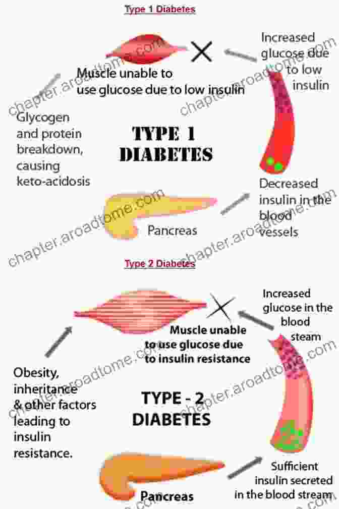 Type 1 And Type 2 Diabetes Perspectives On Type 2 Diabetes (HIV TB And Non Communicable Diseases 1)