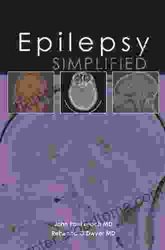 Epilepsy Simplified (Simplified (TFM Publishing))