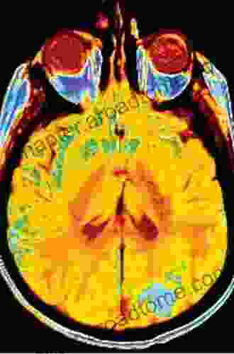 Imaging Of The Human Brain In Health And Disease